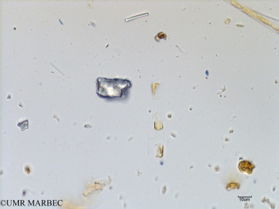 phyto/Scattered_Islands/mayotte_lagoon/SIREME May 2016/Skeletonema costatum (MAY5_skeletonema-3).tif(copy)_thumb.jpg